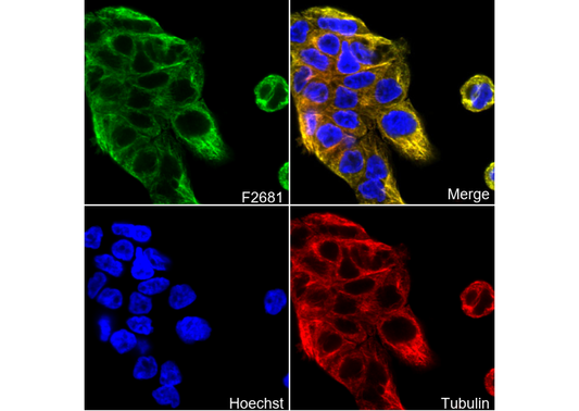 Cytokeratin 5 Antibody