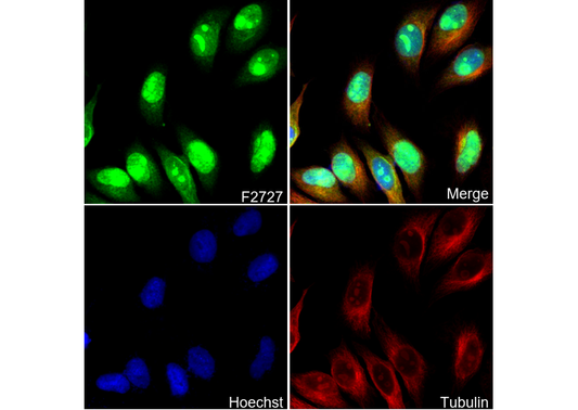 Casein Kinase 2β Antibody