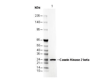 Casein Kinase 2β Antibody
