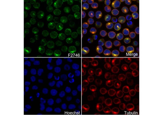 GGT1/GGT Antibody