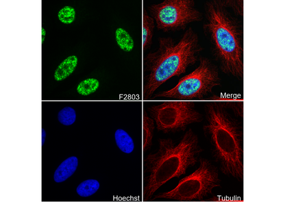 KDM2A Antibody