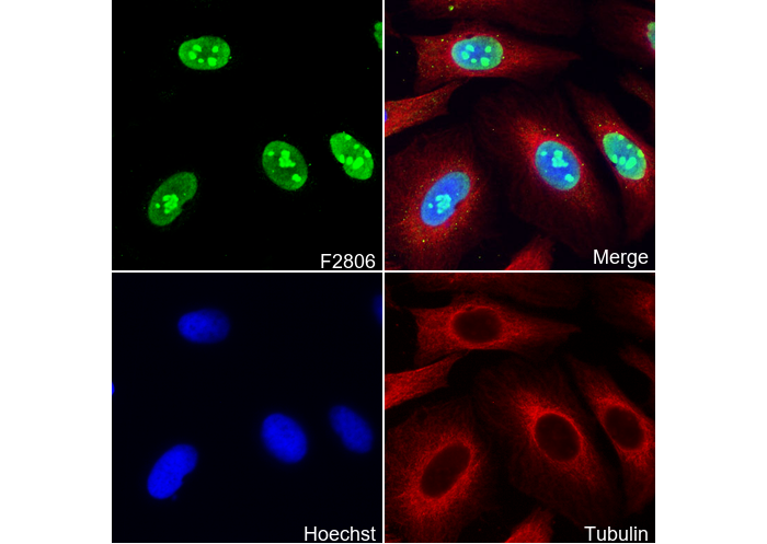 Human Nucleoli Antibody