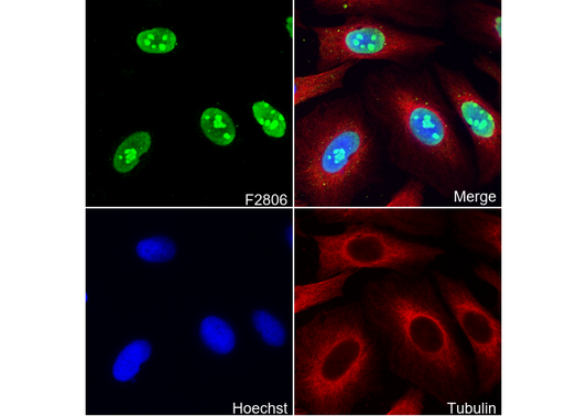 Human Nucleoli Antibody