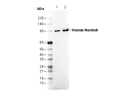 Human Nucleoli Antibody