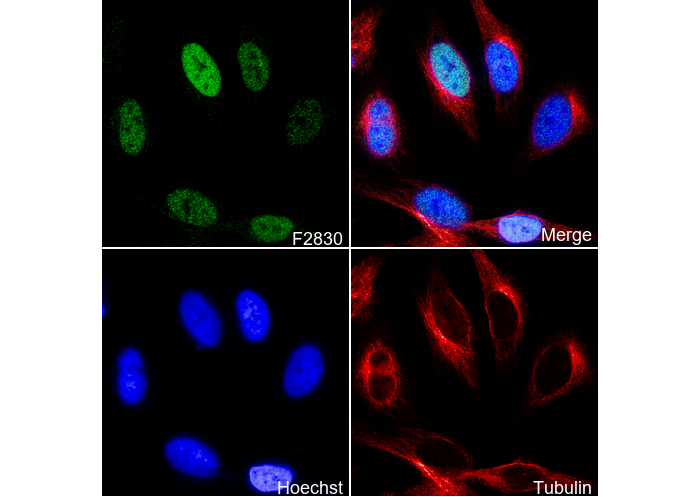 Phospho-ATF2 (Thr71) Antibody