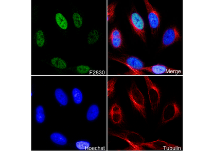 Phospho-ATF2 (Thr71) Antibody