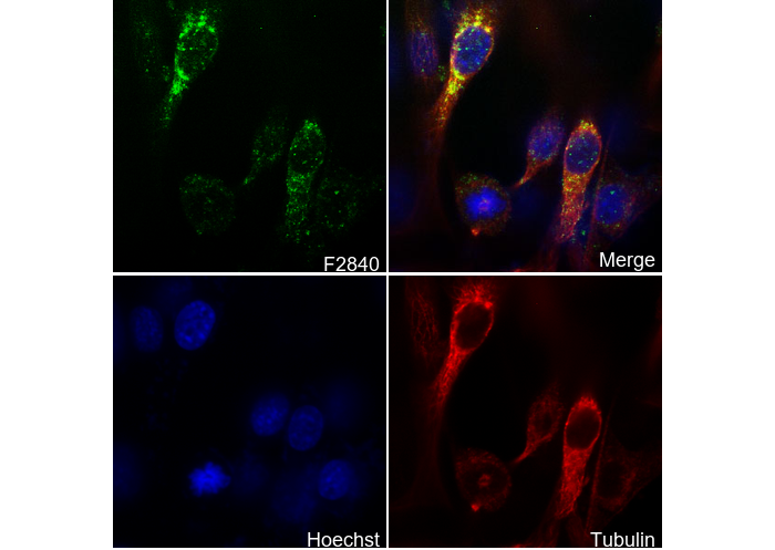 ATP6V1A Antibody