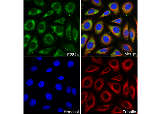 Prostaglandin D Synthase (Lipocalin)/PDS Antibody