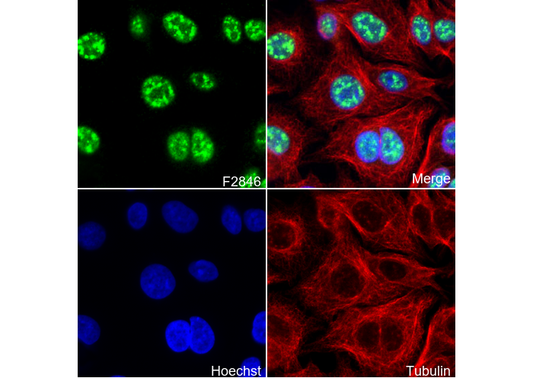 Phospho-Smad3 (Ser423/Ser425) Antibody