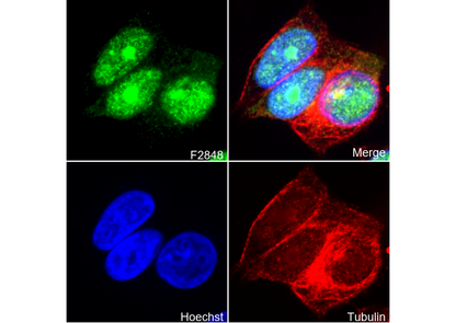 Rb Antibody