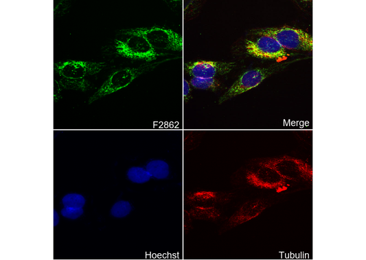 Hexokinase II Antibody