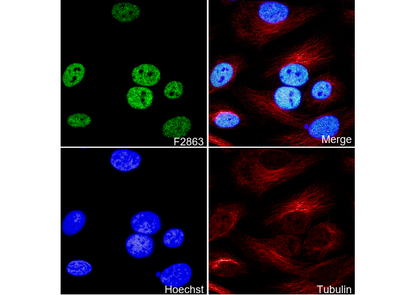 Histone H3 (tri methyl Lys4) Antibody
