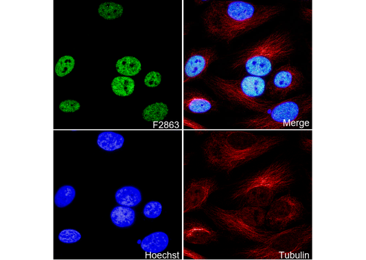 Histone H3 (tri methyl Lys4) Antibody