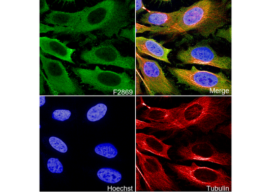 Fatty Acid Synthase Antibody
