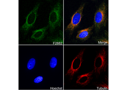 VDAC1/Porin + VDAC2 Antibody
