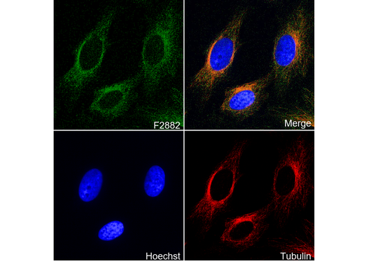 VDAC1/Porin + VDAC2 Antibody
