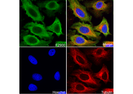 eIF5A Antibody