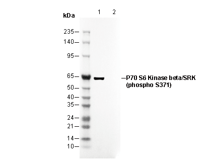 Phospho-P70 S6 Kinase β/SRK (Ser371) Antibody