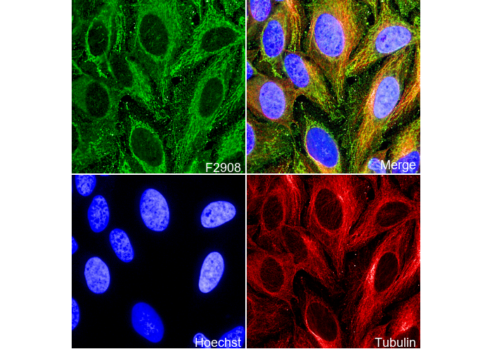 TOMM22/TOM22 Antibody