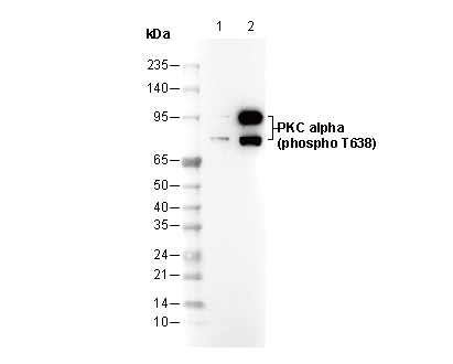 Phospho-PKC α (Thr638) Antibody