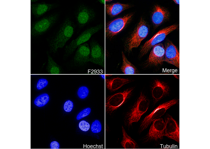 P70 S6 Kinase beta/SRK-N-terminal Antibody