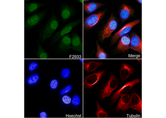 P70 S6 Kinase beta/SRK-N-terminal Antibody