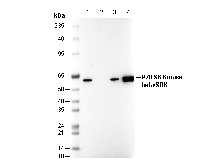 P70 S6 Kinase beta/SRK-N-terminal Antibody