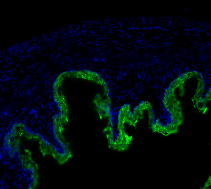 Cytokeratin 1 Antibody