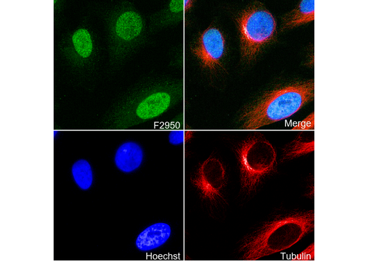 Acetyl-Histone H3 (Lys9) Antibody