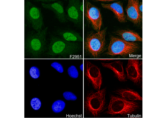 ATM Antibody