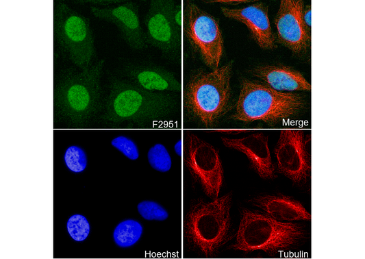 ATM Antibody
