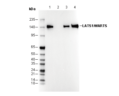 LATS1/WARTS Antibody