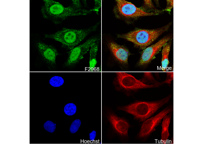 SSB Antibody