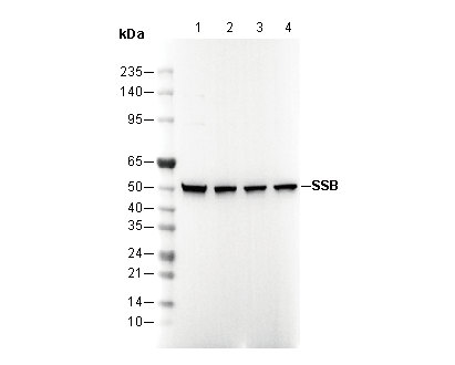 SSB Antibody