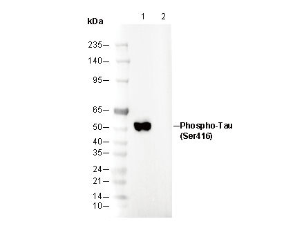 Phospho-Tau (Ser416) Antibody