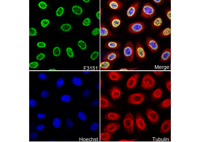 Matrin 3 Antibody