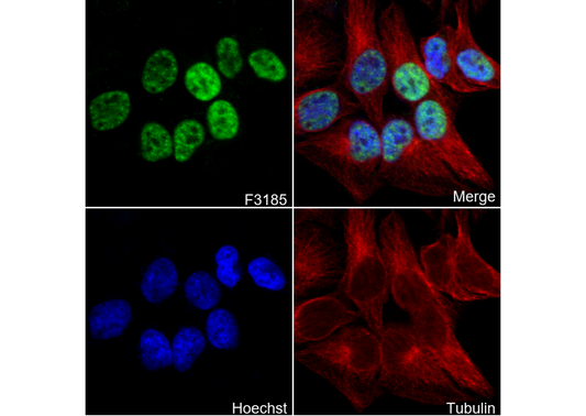 Phospho-CDK1 (T161) + CDK2/3 (T160) Antibody