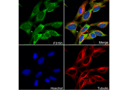 CCL4/MIP-1β Antibody