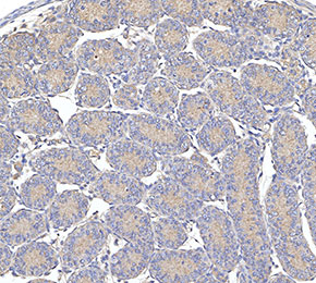 MCP1 Antibody