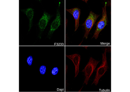 Bad Antibody