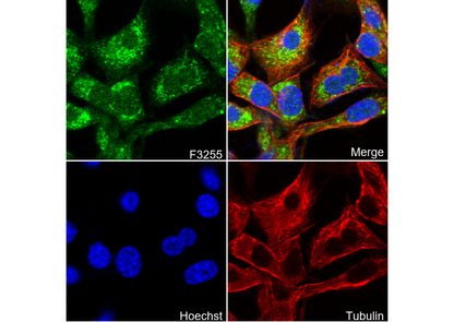 ATGL Antibody