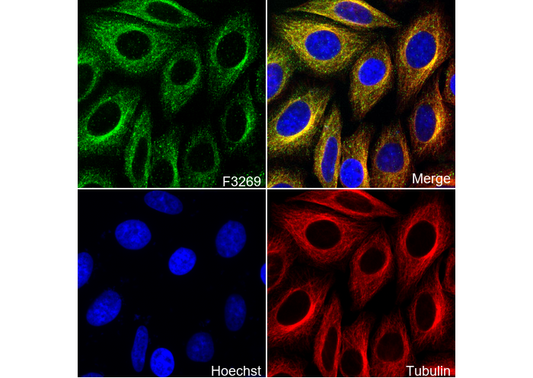 Arginase 1 Antibody