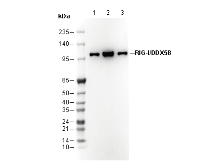 RIG-I / DDX58 Antibody