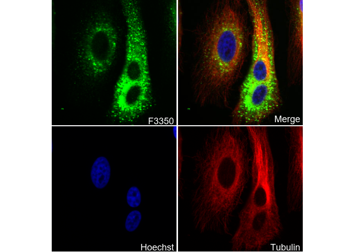 Calreticulin Antibody
