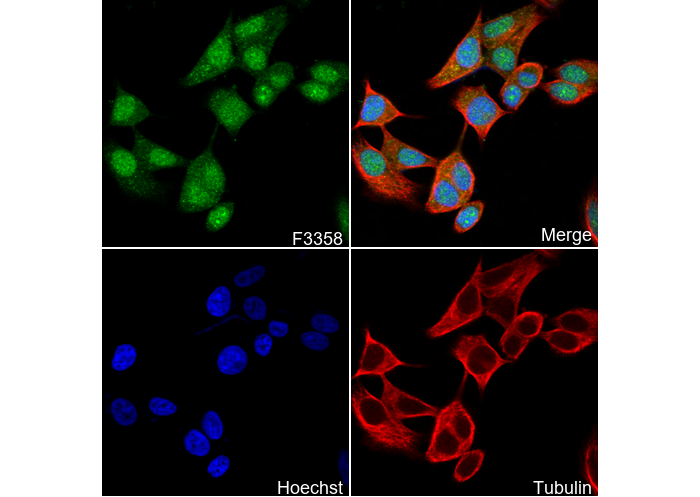 Phospho-Estrogen Receptor α (Ser118) Antibody