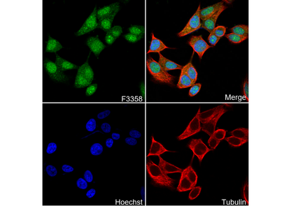 Phospho-Estrogen Receptor α (Ser118) Antibody