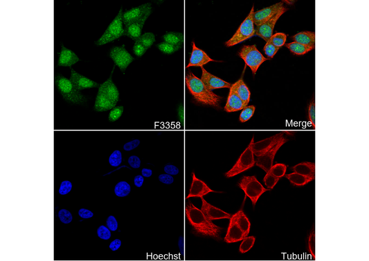 Phospho-Estrogen Receptor α (Ser118) Antibody
