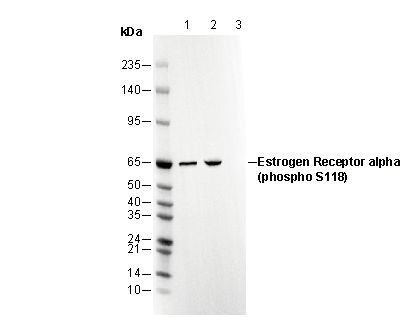 Phospho-Estrogen Receptor α (Ser118) Antibody