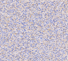 β Amyloid (Aβ) 1-42 Antibody