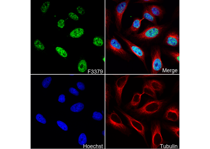 Fos B Antibody